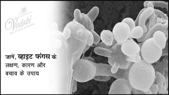 जानें, व्हाइट फंगस के लक्षण, कारण और बचाव के उपाय