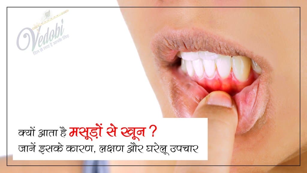 क्यों आता है मसूड़ों से खून? जानें इसके कारण, लक्षण और घरेलू उपचार