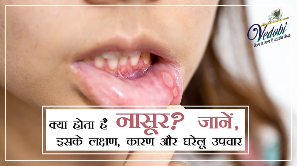 क्या होता है नासूर? जानें, इसके लक्षण, कारण और घरेलू उपचार