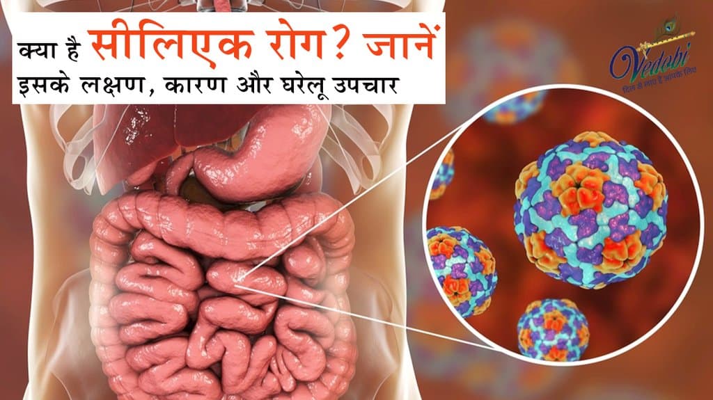 क्या है सीलिएक रोग? जानें इसके लक्षण, कारण और घरेलू उपचार