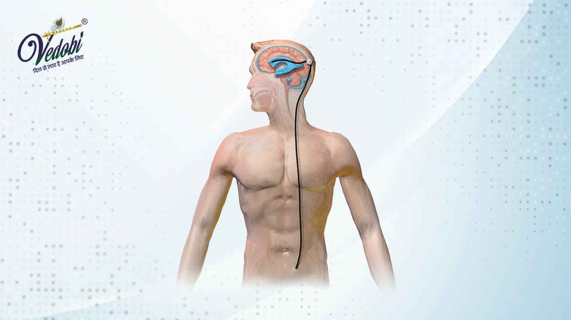 Hydrocephalus: Symptoms, Causes, Diagnosis and Treatment