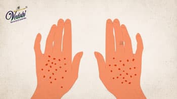 Porphyria: Symptoms, Causes and Treatment