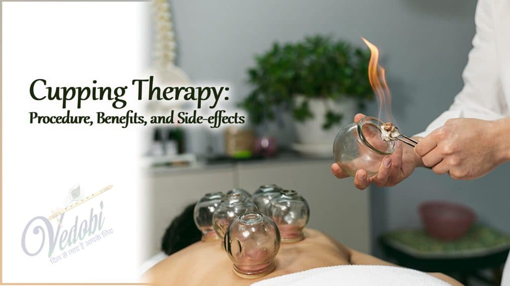 Cupping Therapy: Procedure, Benefits, and Side-effects