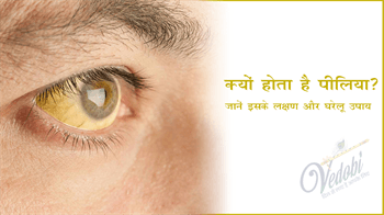 क्यों होता है पीलिया? जानें इसके लक्षण और घरेलू उपाय