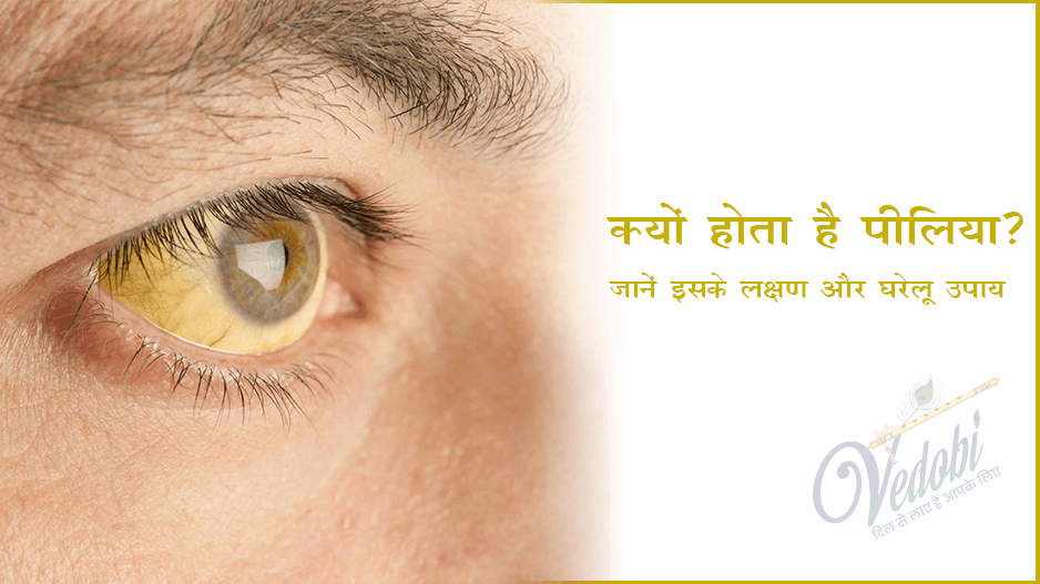क्यों होता है पीलिया? जानें इसके लक्षण और घरेलू उपाय