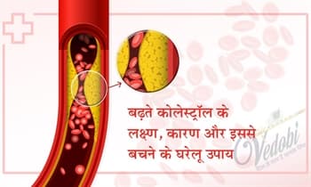 बढ़ते कोलेस्ट्रॉल के लक्षण, कारण और इससे बचने के घरेलू उपाय