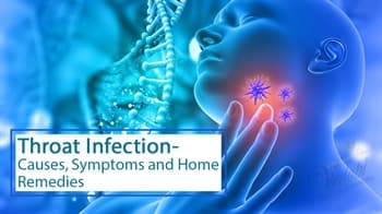 Throat Infection- Causes, Symptoms and Home Remedies