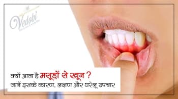 क्यों आता है मसूड़ों से खून? जानें इसके कारण, लक्षण और घरेलू उपचार