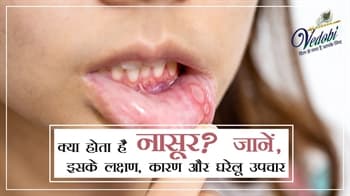 क्या होता है नासूर? जानें, इसके लक्षण, कारण और घरेलू उपचार