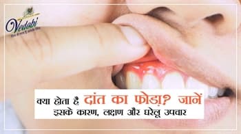 क्या होता है दांत का फोड़ा?जानें इसके कारण,लक्षण और घरेलू उपचार