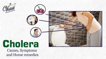 Cholera- Causes, Symptoms and Home remedies