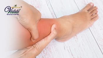 Know the Symptoms, Causes, Diagnosis and Treatment of Edema